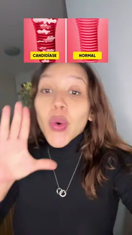 Ja teve ou tem candidiase ou vaginose? 