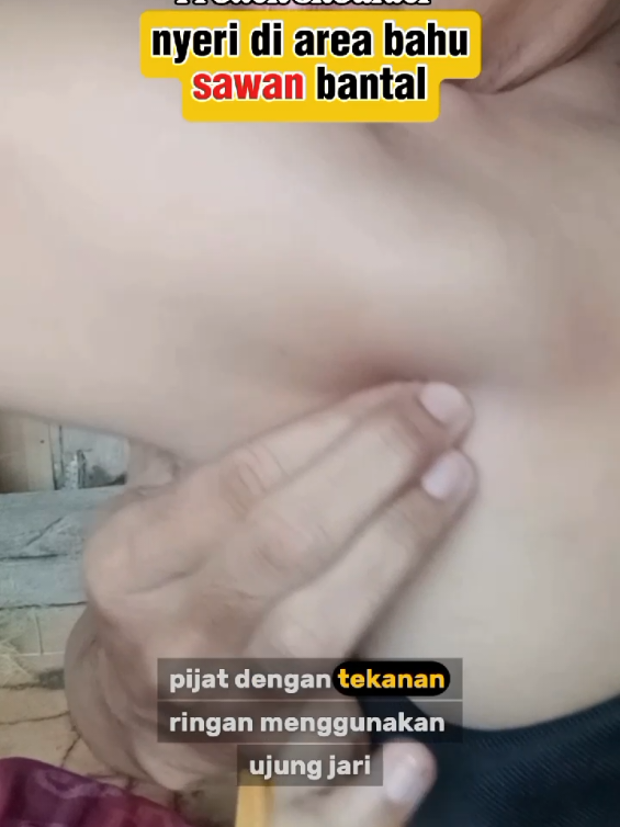 Frozen shoulder, bahu terasa kaku dan nyeri