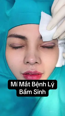 Mí Bệnh Lý Can Thiệp Những Phương Pháp Nào Để Cải Thiện Cùng Xem Hết Video Này Nhé Ty ☘️☘️#suami #catmi #hasizemi #matdouyin 