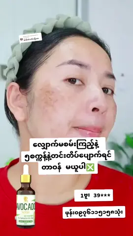 Replying to @ko.zaw.kozaw93 လျှောက်မစမ်းနဲ့နော် #grow #viral #foryou #foryoupage #foryoutiktok 