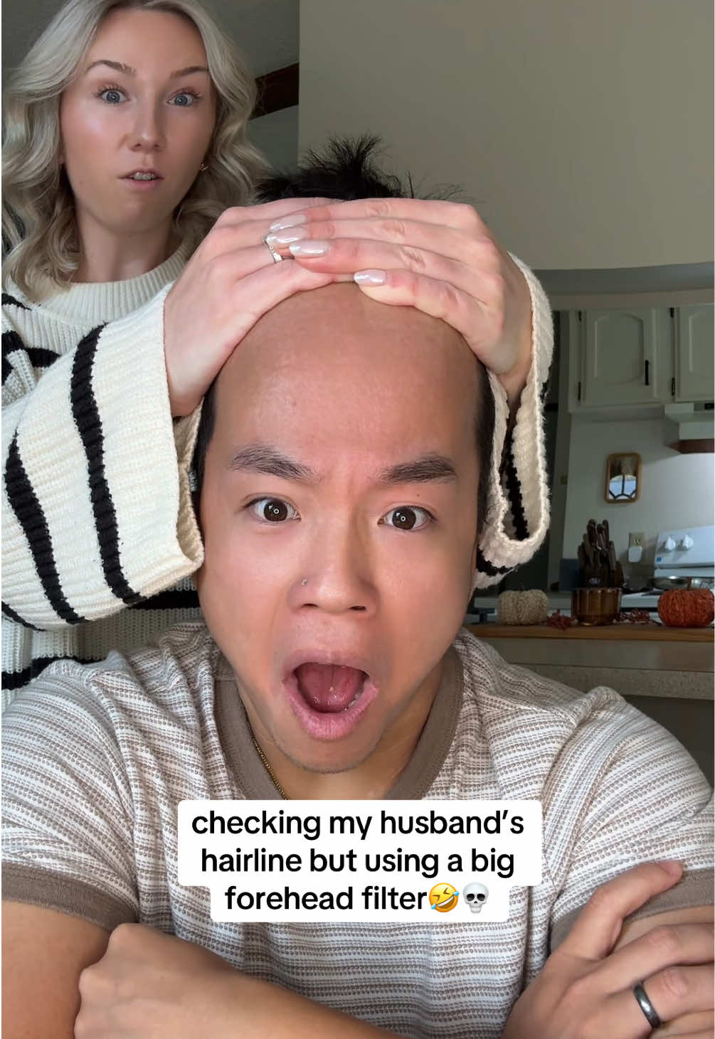 he’s gonna worry about his hairline now😅 #trend #relationships #couple #funny #humor 