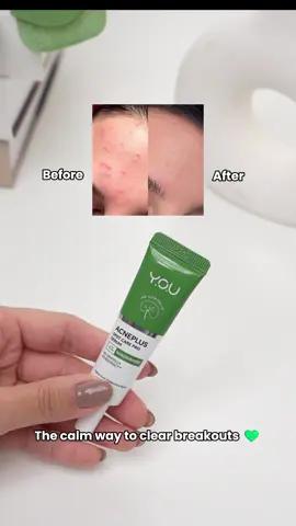 Spot it. Calm it. See less in 12 hours.😍