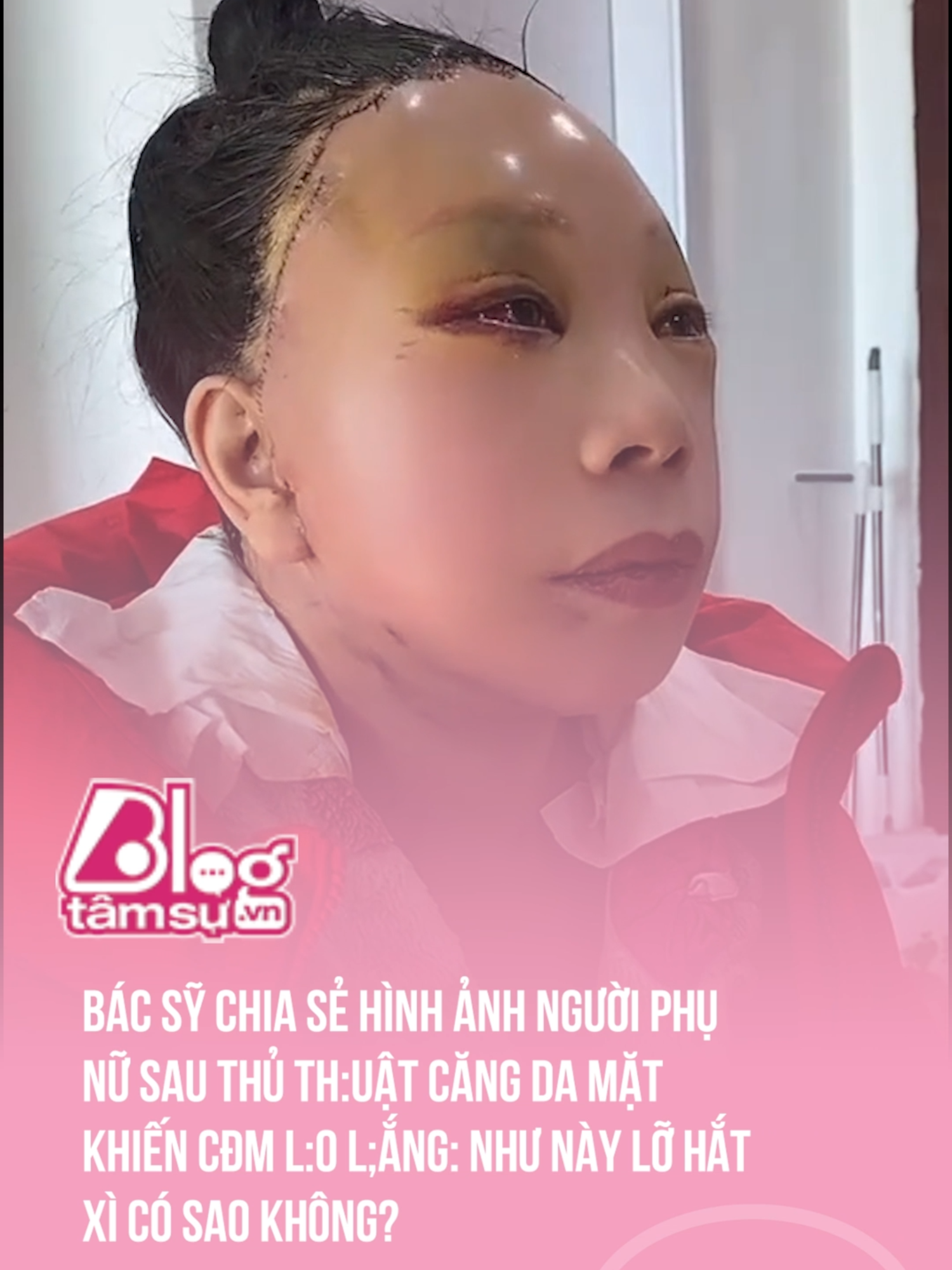 Căng quá rồi đó #blogtamsu #btsmedia #beauty #trending