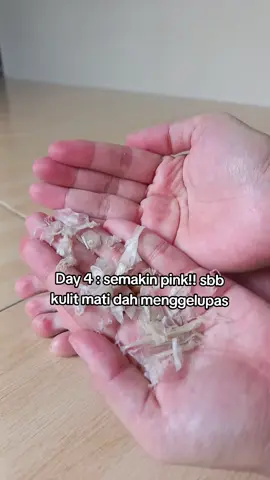 Part 20 : kulit kaki menggelupas buang kulit mati guna Foot mask ni je 60min ✨ #sarawaktiktok #sarawakfyppp #tumitku #exfoliateyourskin #maskerviral 