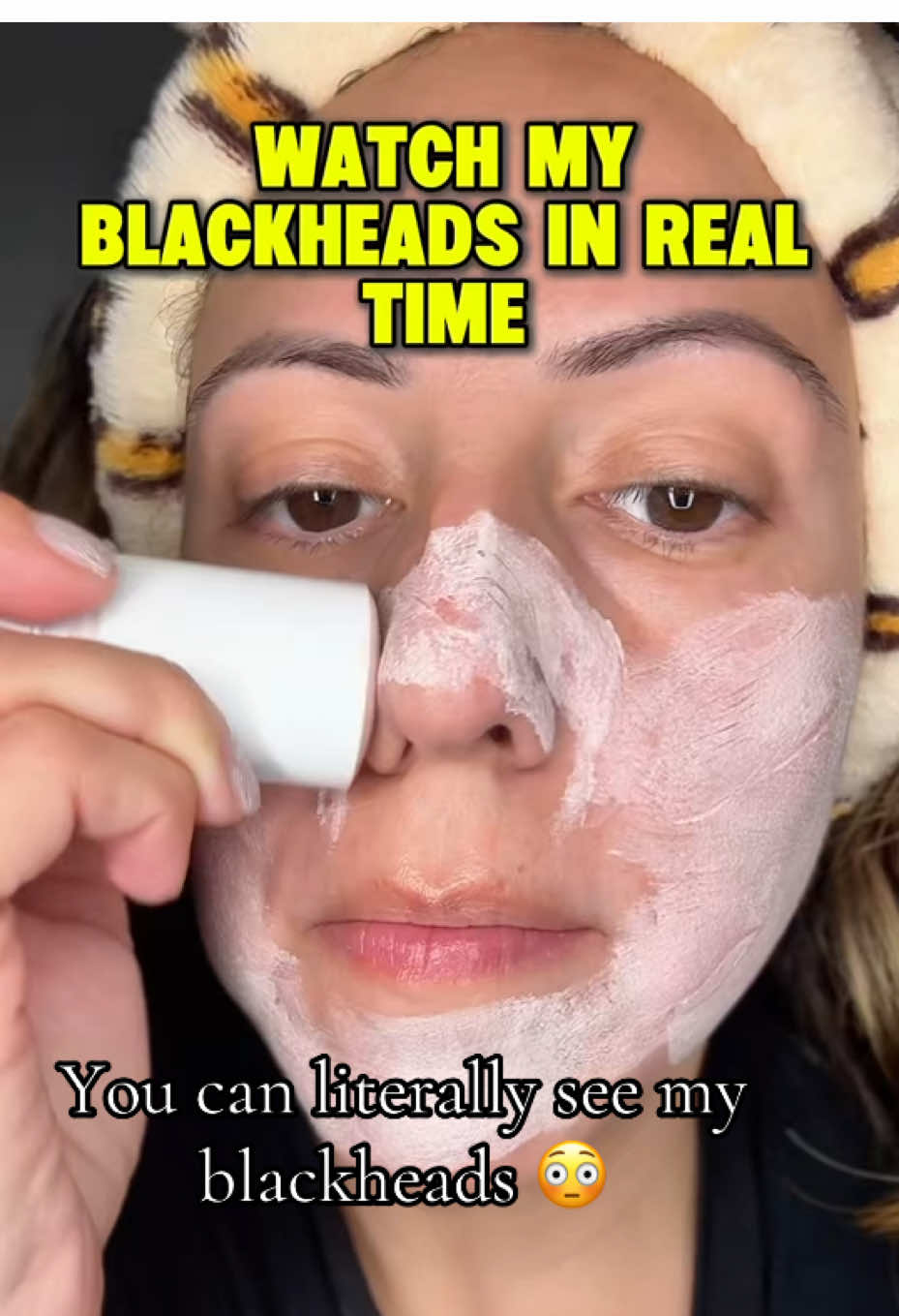 You can literally see your blackheads appear as it works 👀 The SKIN1004 Poremizing Quick Clay Stick Mask pulls out impurities and unclogs pores fast — leaving skin smooth, hydrated, and calm. Perfect for sensitive skin and visible results in minutes. #ViralClayMask #SKIN1004 #BlackheadCare #KBeautyFinds #PoreCare 