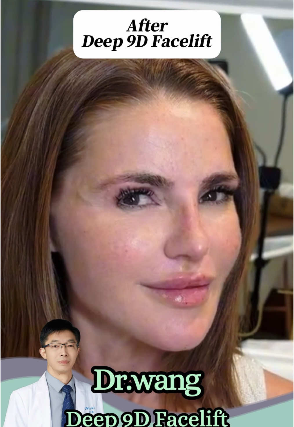 She used to hide behind makeup, afraid to face her own reflection — the loose skin, the lost glow, the years that felt heavier than they should. 💭 After the Deep 9D Facelift, everything changed. Her skin looks firm, her eyes brighter, her confidence unstoppable.✨ #Deep9DFacelift #FacialRejuvenation #YouthfulGlow #DrWangClinic #TimelessBeauty #ConfidenceRestored #beautytransformation 