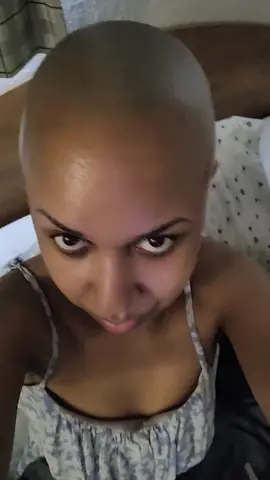 I love being bald🤍❤️ my dream wig is coming as well the inverted bob wig coming on my way❤️🩷 #naurtalbeautybaldwomen  #prettybaldiewithnomakeup 