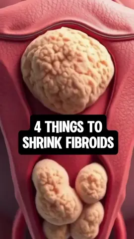 That’s why Plnat based Protein is really necessary to help shrink it. And also incorporating herbs for a gentle support is key  #Fibroids #Trending #viral #viraltiktok #fyp