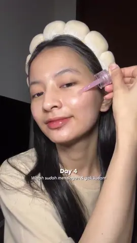 Masih bingung cara mengatasi noda hitam dan kulit kusam yang membandel? Jawaban bisa kamu temukan di Triple Bright Radiance Skindrops, jangan lupa check out ya Glamz 🥰 #glamazing #skincarelokalrasakorea #skindrops 