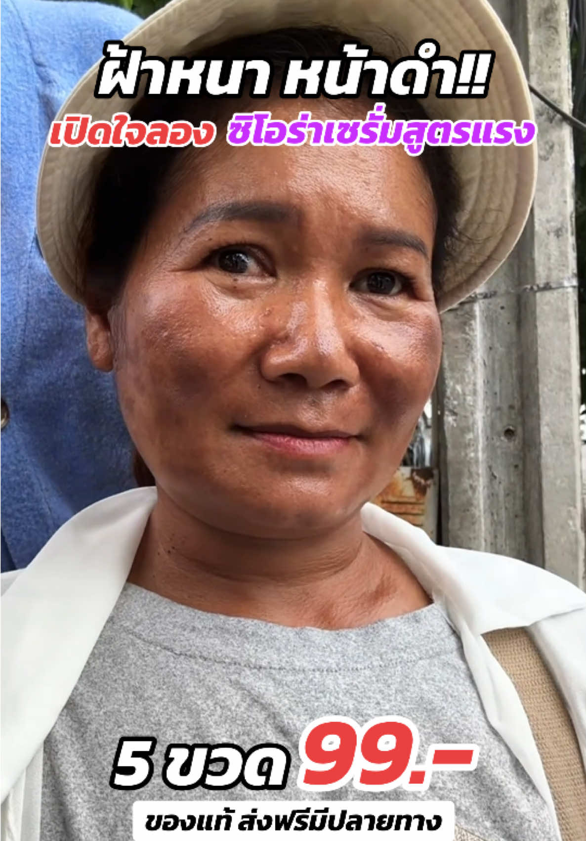 ฝ้าหนา หน้าดำ ต้องลองซิโอร่าสูตรนี้!! #ซิโอร่าเซรั่ม #ซิโอร่า #ลดฝ้ากระจุดด่างดํา #niacinamide #tiktokshop 