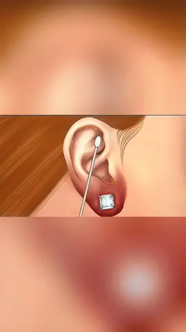 ASMR [ Satisfying Video ] #soonent #satisfyingvideo #care #facecare #skincare 