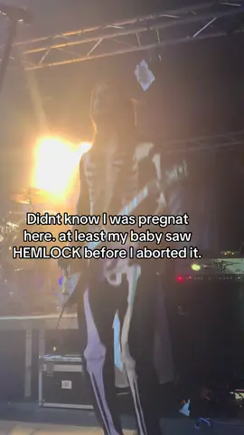 #metal #fyp #fy #foryou 