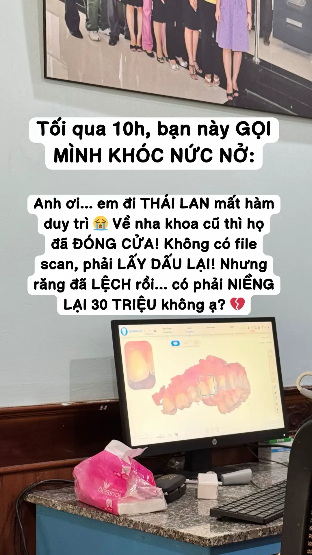 Khách tui dạo này đi Thái nhiều vậy ta #hamduytri #niengrang #vietdentallab #retainer #hamduytritrongsuot 