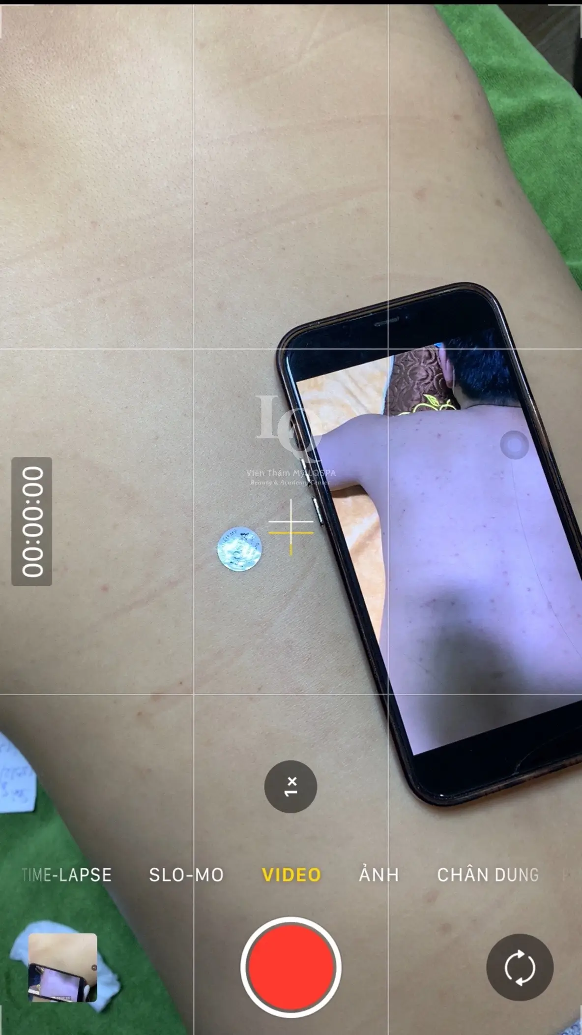 Cập nhật mụn lưng#chamsocdamun#chamsocdaseo#chamsocdanam#tanbinh#Lqspa&academy