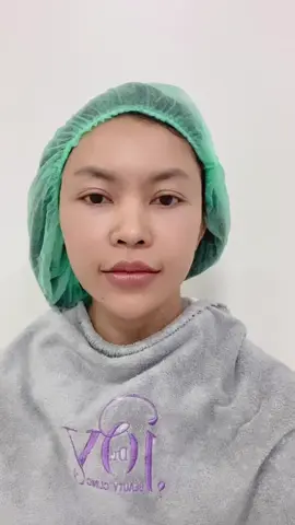 #เสริมจมูก  #นครศรีธรรมราช #คลินิกหมอจอย  7วันจึ้งมากแม่