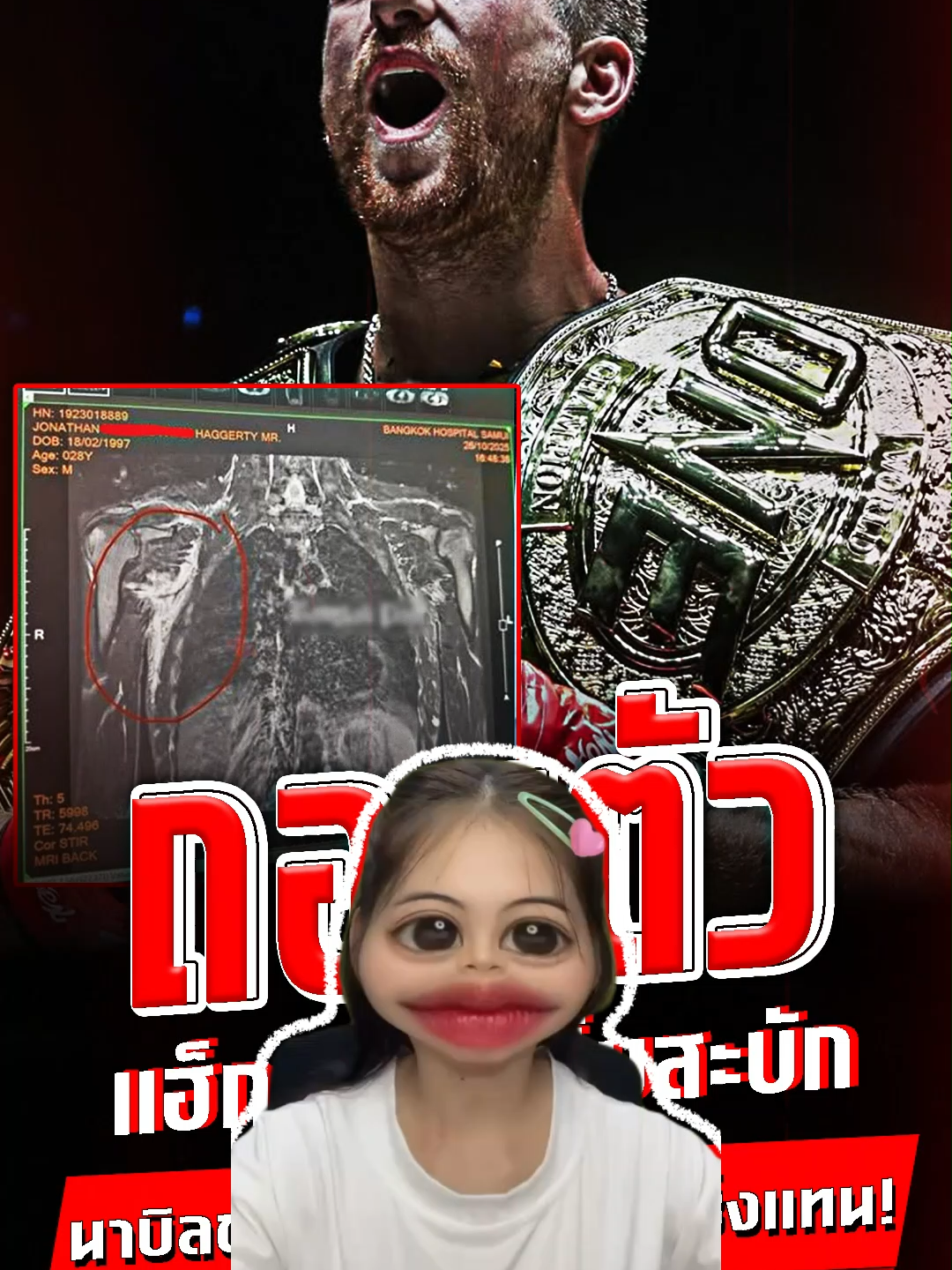 ดราม่าแฮ้กเกแร์ตี้คค่ะ ถอนตัว #one #onechampionship #หมวยลี่ติดนวม #kingboxing #UFC #mma @muay_ly01