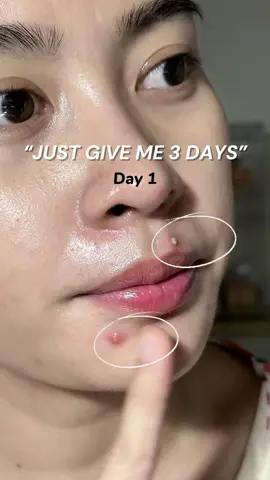 3 days?!! Howwww???? @trueve.id #promomakanharian #moisturizer #acnetreatment 