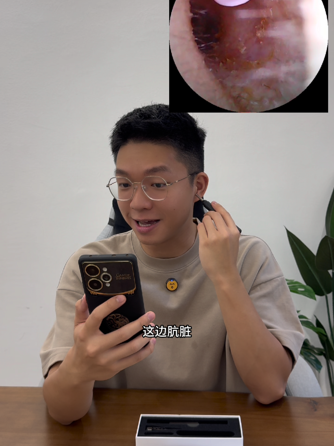 千万不要再用棉花棒挖耳朵了🙈 #烧卖精选 #烧卖精选 