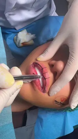 Thật nhẹ nhàng tự nhiên cho em là được ạ 🥰🥰🥰 #cắtmoi #môibaby #cắtmôidày 