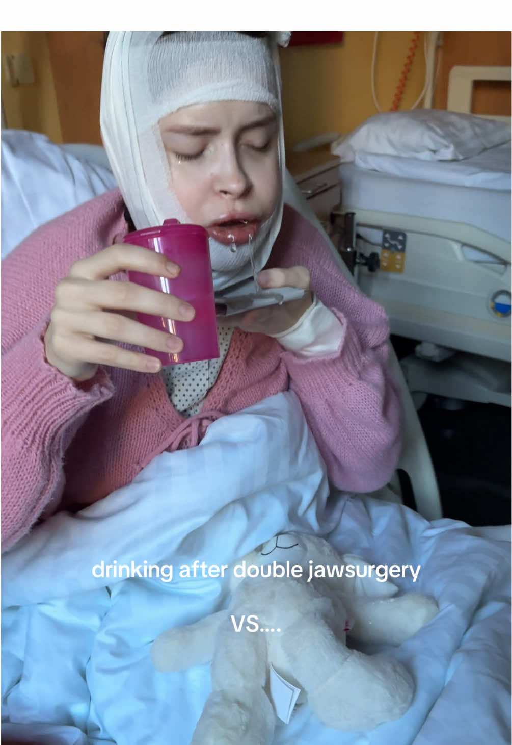 I‘m so proud 🥹 you all can do this!! ❤️‍🩹🫂  #doublejawsurgery #jawsurgeryrecovery #bimaxop #gne #jawsurgery 