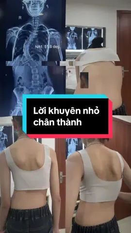 Lời khuyên chân thành tới các bạn trẻ #congveocotsong #veocotsong #aonanchinhcotsong #vẹocộtsống #vatlytrilieu 