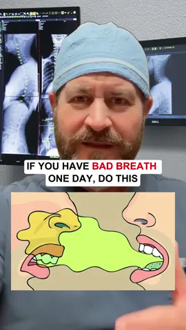 If you have bad breath one day, do this — I guarantee it works #badbreath #health #healthy #healthtip #healthtips 