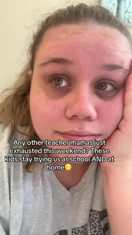 The eye bags are baggin’ today 