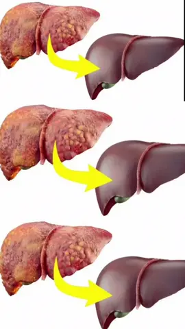 чистить печени#drink#foryou#fyp#natural5550 