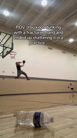 Bionic hand coming soon #fyp #dunking #xray #brokenbone #basketball 