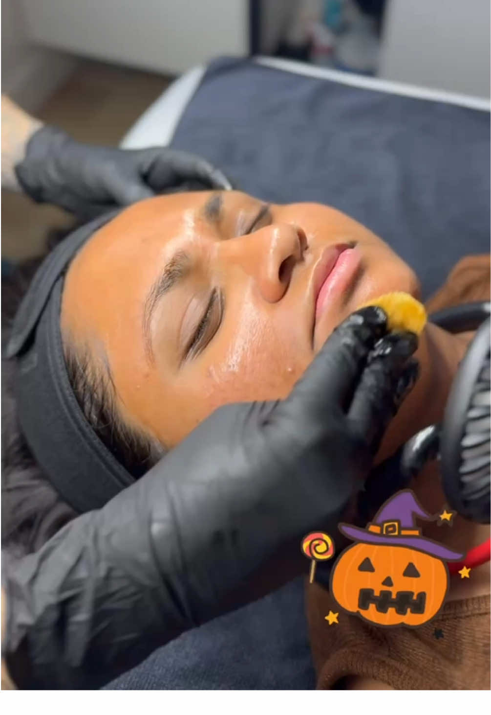 Peel season gives the Halloween jump scare all fall/winter long 👻🎃 #aesthetician #peelseason #chemicalpeel 