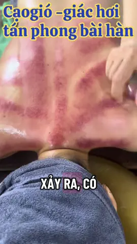 Dấu hiệu nguy cơ đột quỵ mà bạn cần biết #Thơspa #massatriliệu 