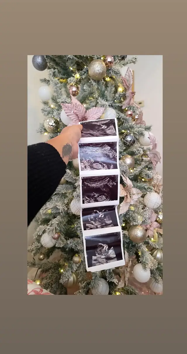 @jhonnuez45  #bebeencamino🤰 #infertility #embarazadastiktok 