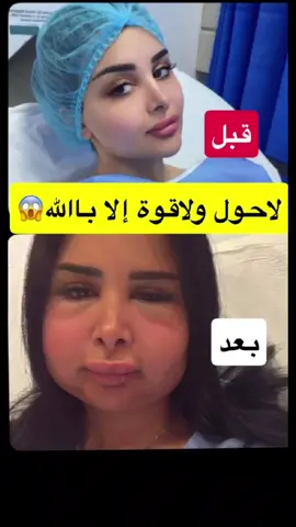 #حسبي_الله #❤️🙏🙏🥀 #oopp597 