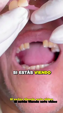 Contacto WhatsApp 3015875109  Entregamos tu prótesis dental en tan solo 4 horas!   Agenda tu cita ahora mismo ! 