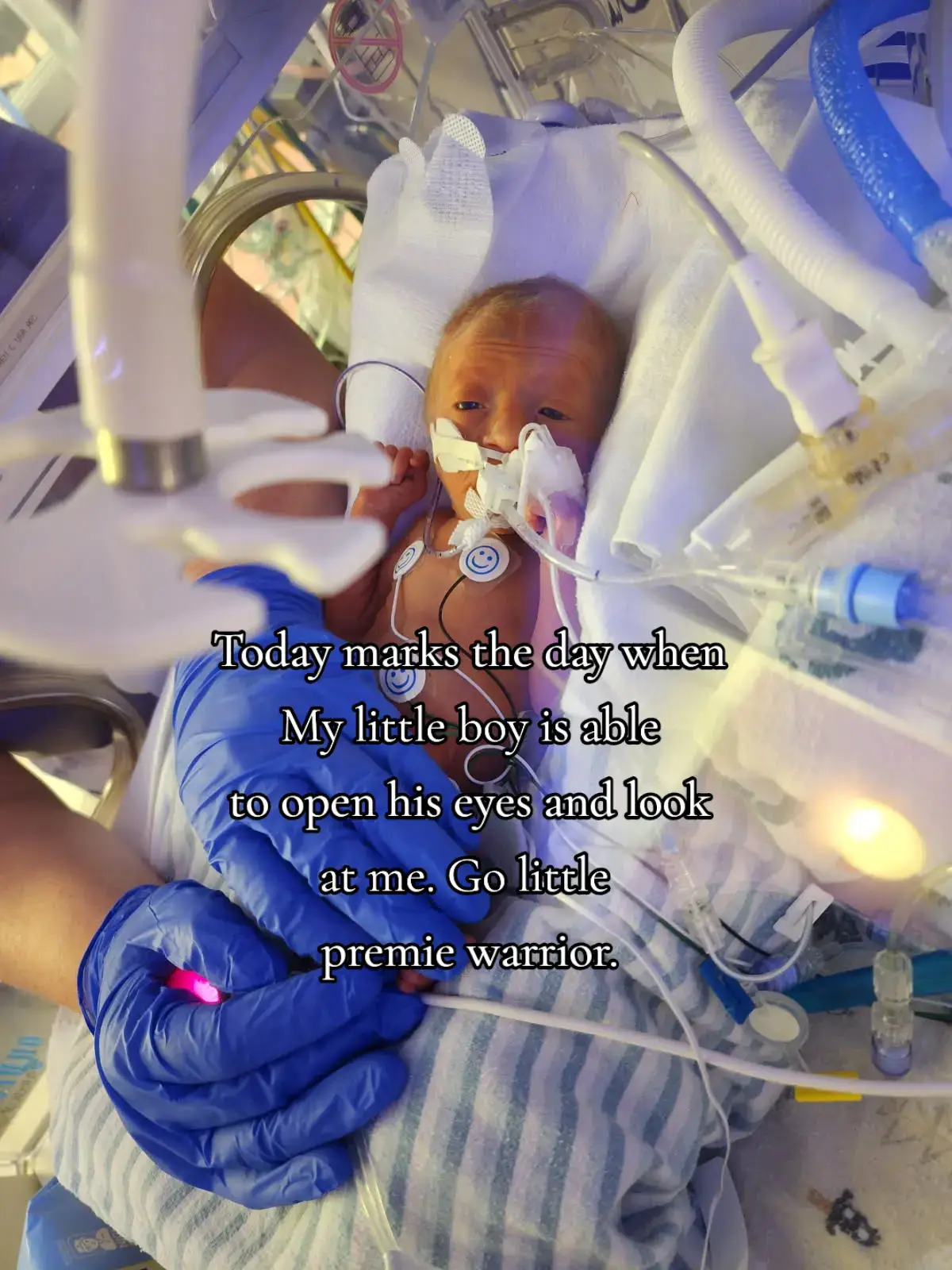It's the little things you can't forget when you have two preemie twins in the NICU. This is my little boy Gideon born at 30 weeks. May he never forget how much mama loves him. #premie #premiebaby #prematurebaby #nicu #nicubaby 