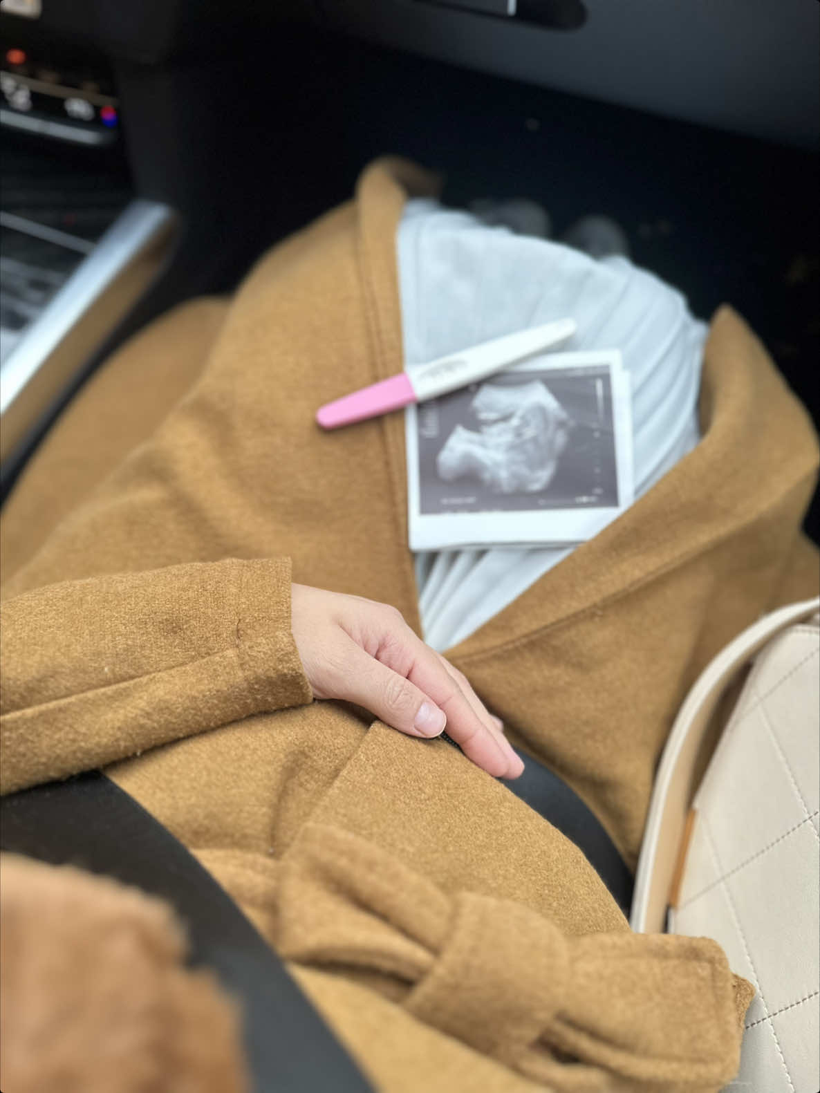 شو وضع الحالي؟ #اكسبلور_explore #اكسبلور_فولو #ريلز #اكسبلور #حمل 