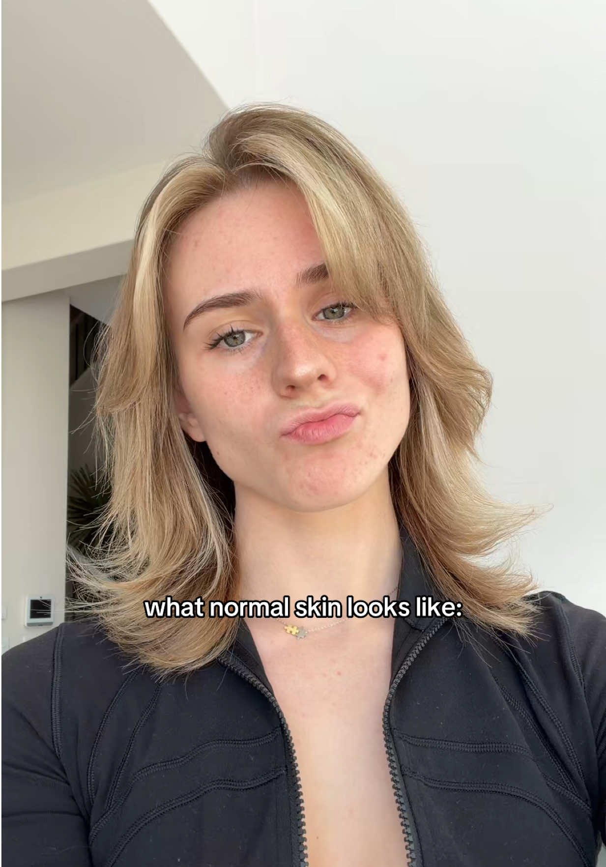 acne, pores, dark spots… all normal🫶🏼 (a reminder for myself tbh) #acne #acnetips #skincare #hormonalacne 