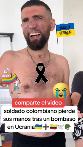 soldado colombiano pierde sus brazos en Ucrania 🇺🇦➕🇨🇴🕊️🪖🫡