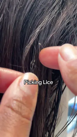 Picking lice from a client l lice removal #fyp #hair #lice #momlife #school 