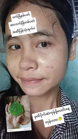 တစ်နေ့နှစ်ကြိမ်ပဲသစ်ပေးမသိသာဖူးမသက်သာဖူးဆိုချက်ချင်းဖုန်းဆက်ငွေပြန်အမ်းမယ်🫢🫶🐝💚#teပျားမျက်နှာသစ်ဆပ်ပြာ #ပြည်မြို့ #Viber09409205811 