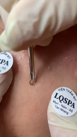 Nhẹ #chamsocdamun#chamsocdaseo#chamsocdanam#tanbinh#Lqspa&academy