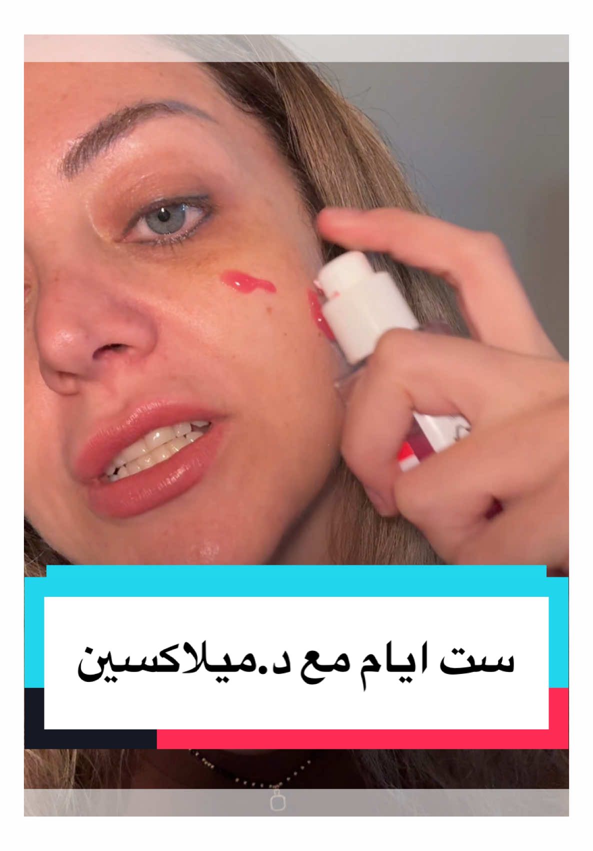 🌸 بعد 6 أيام من استخدام Dr. Melaxin Cemenrete حسّيت وجهي رجع يتنفّس حرفيًا! البشرة صارت أفتح، أنعم، والمسام ضاقت بشكل ملحوظ 💫 الـ Cyano Pink Spicule Serum حسّيته مثل مايكرو نيدلينغ خفيف بالبيت، بيجدد البشرة وبيحفّز الكولاجين، والـ Picotonic Shot ساعد يخفّف البقع ويلمّع البشرة من غير لمعة مزعجة ✨ النتيجة؟ بشرة مشدودة، صافية ومشرقة متل فلاتر الكاميرا بس بالحقيقة 😍 #DrMelaxin #SkincareResults #Kbeauty #GlowSkin #dealsforyoudays @Dr.Melaxin Global @Dr Melaxin Official  