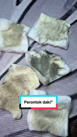 Punya slengki hitam / bekas luka korengan gosokkan deh pake toner ini #tonerbadan #sybtonerbadan 