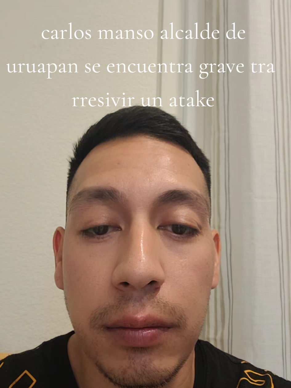 #viralvideo carlos manso al calde de uruapan se en cuentra grave tras rresibir varios disparos por un sospechoso