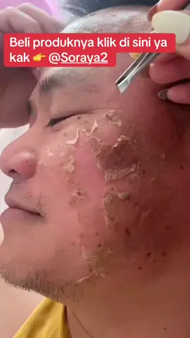 BELI PRODUK DAN KERANJANG KUNINGNYA KLIK DI SINI YA KAK 👉   @Soraya2 