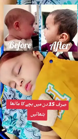 bacha ka matha kesa dabae #10 .mah k bachay ka sir bad jaye bachy ka sar banany ka takiabachon ka matha bithany ka tariqa babies forehead shape#ukbaby  #baby forehead shape#usababy #3monthbaby  k bachy ka Baby forehead correctio headshape kese bnayen