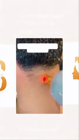 We offer all aesthetic treatments with best results. Client’s satisfaction quarantined! 03356400959 #drbilalkhan #dermatologist #brimishskincare #foryoupage❤️❤️ #viral 