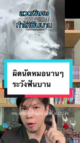 ระวังลวดตัวนี้ทำให้ฟันบาน #จัดฟัน #คลินิกจัดฟันหาดใหญ่ #ฟันยื่น #ฟันบาน #curveofspee