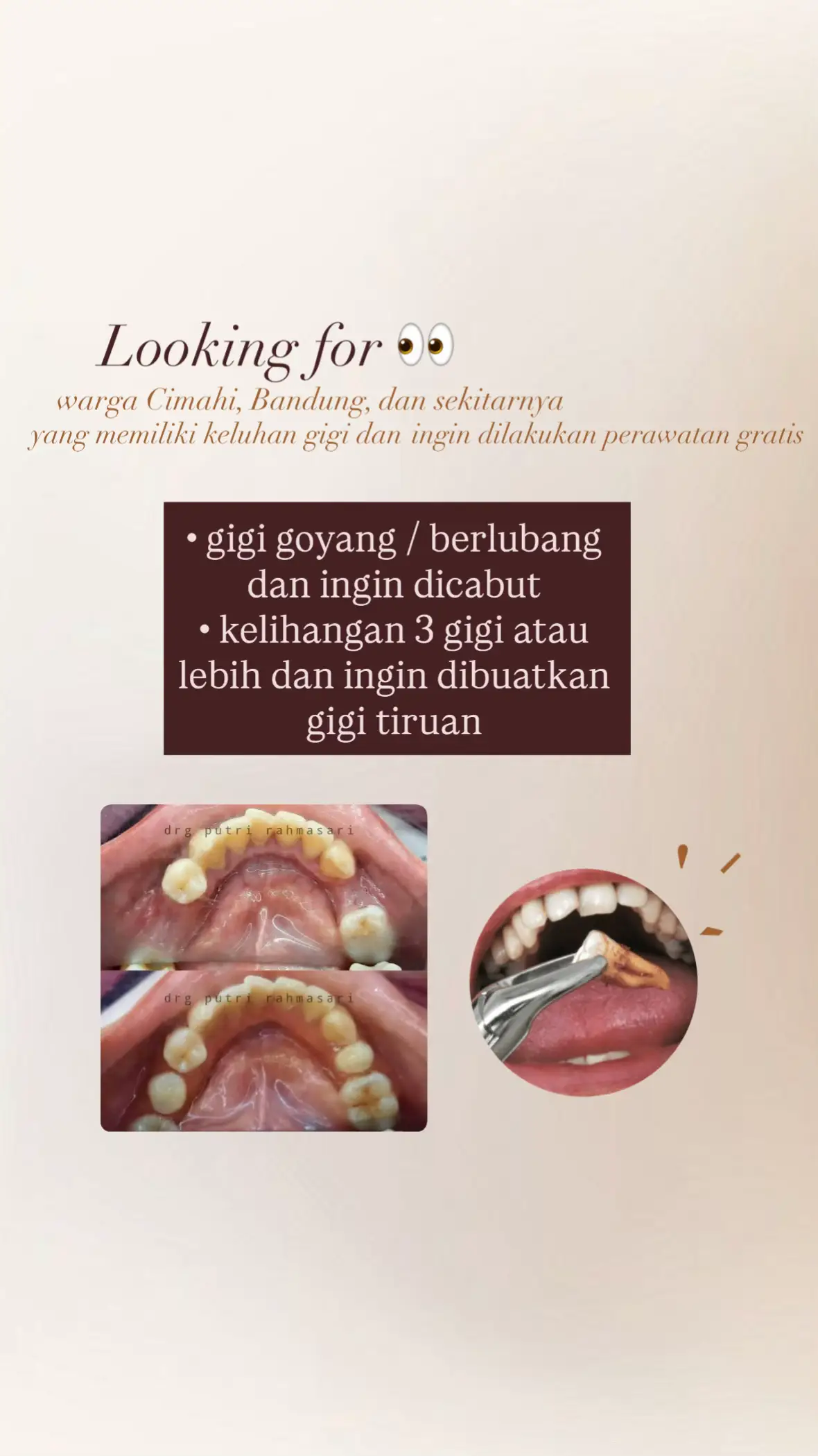 Halo buat ibu, bapak, temen” semua yg di Cimahi, Padalarang, Bandung, dan sekitarnya ya g memiliki keluhan seperti diatas dan ingin dilakukan perawatan gratis, bole dm yaa♡!! #koasgigi #cabutgigi #gigipalsu #cimahi #bandung 