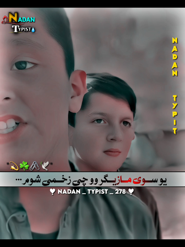 سہ دہ غم مازیگر وو چی زخمی شوم 💔🗡️🥺 #foryou #foryoupage #viral #video #unfrezzmyaccount 
